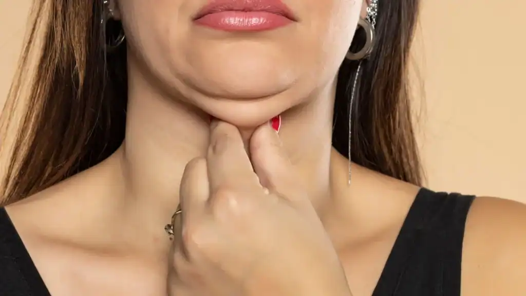 An image of a woman with double chin, sad, worried : Non Surgical Double Chin Removal Treatment in Newham, UK