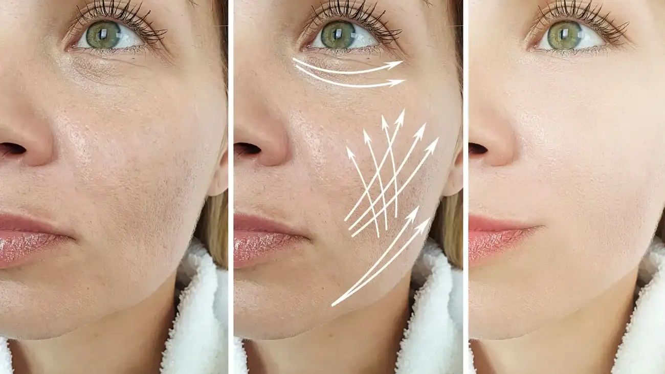 Can One Treatment Really Tackle More Than One Skin Concern Newham?
