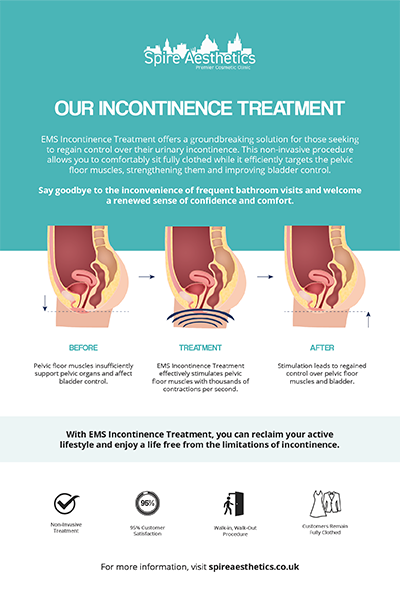 image of how urge incontinence Newham treatment works